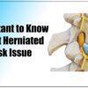 Herniated Disc Physical Therapy A Comprehensive Guide