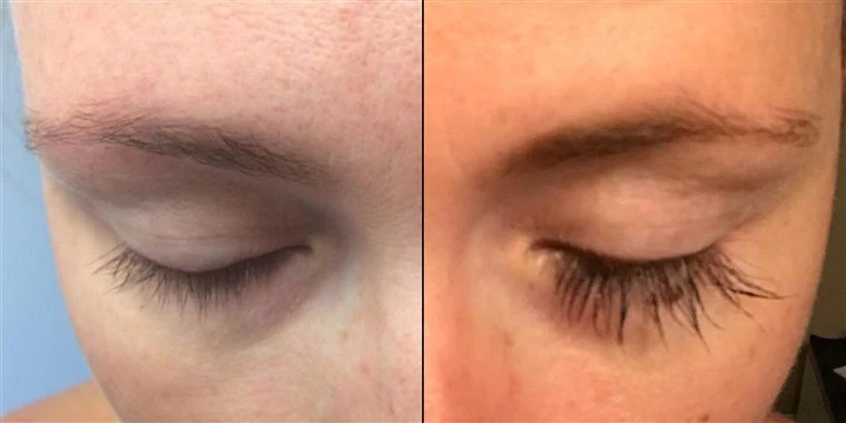 Should you ditch your eyelash growth serums