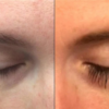 Should You Ditch Your Eyelash Growth Serums?
