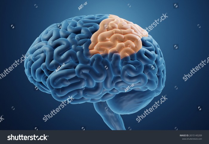 Effects of a parietal lobe stroke