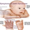 Understanding Symptoms of Down Syndrome