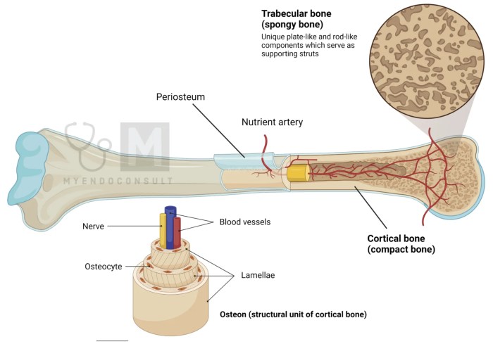 Bone spur on big toe